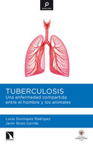 Imagen de portada del libro Tuberculosis