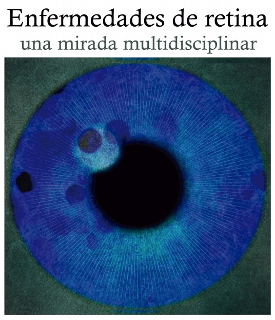 Imagen de portada del libro Enfermedades de la retina