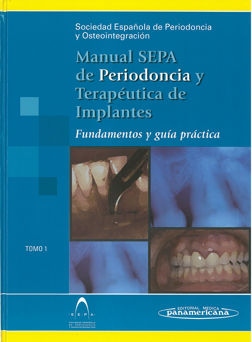 Imagen de portada del libro Manual SEPA de Periodoncia y Terapéutica de Implantes