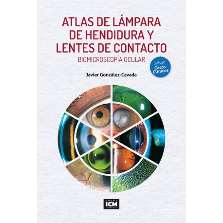 Imagen de portada del libro Atlas de lámpara de hendidura y lentes de contacto