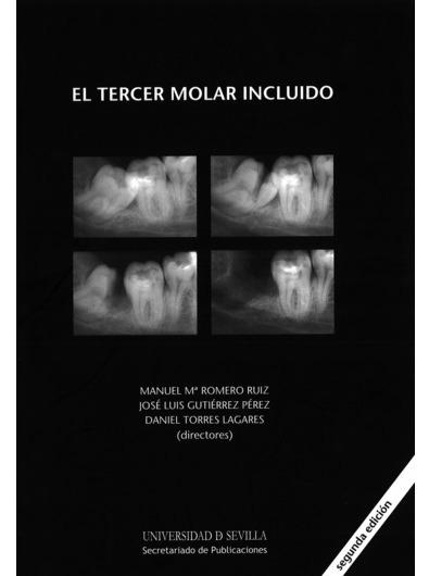 Imagen de portada del libro El tercer molar incluido