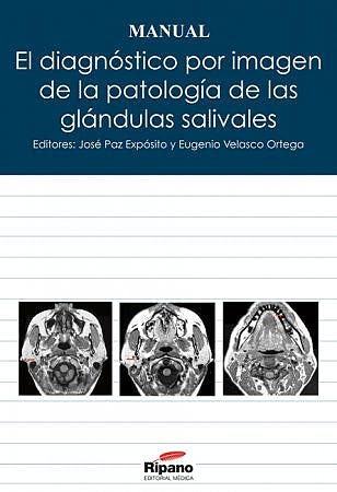 Imagen de portada del libro El diagnóstico por imagen de la patología de las glándulas salivales