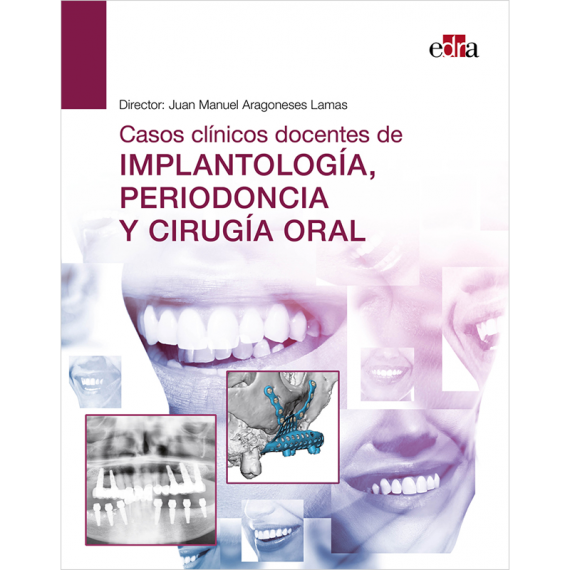 Imagen de portada del libro Casos clínicos docentes de implantología, periodoncia y cirugía oral