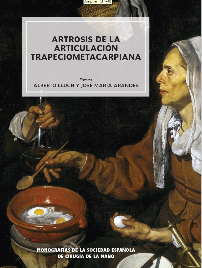 Imagen de portada del libro Artrosis de la articulación trapeciometacarpiana