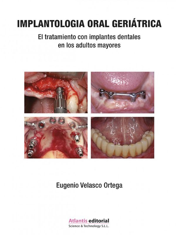 Imagen de portada del libro Implantología oral geriátrica