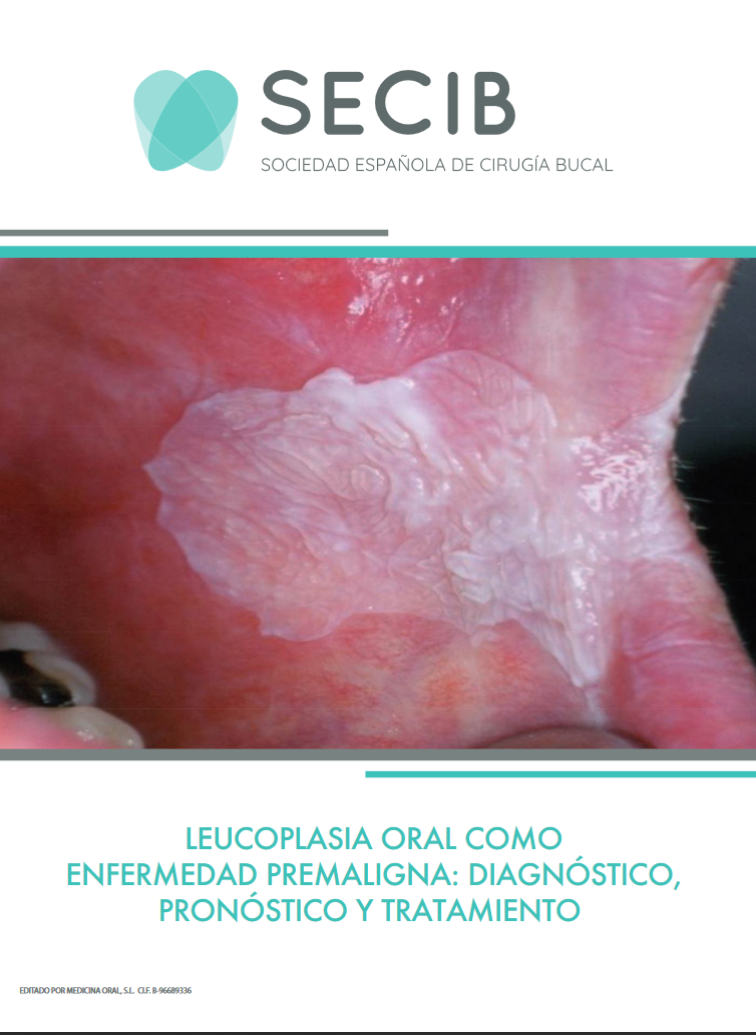 Imagen de portada del libro Guía de práctica clínica de leucoplasia oral
