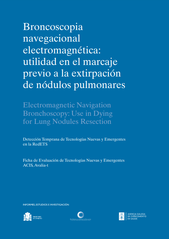 Imagen de portada del libro Broncoscopia navegacional electromagnética: utilidad en el marcaje previo a la extirpación de nódulos pulmonares