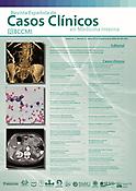 Imagen de portada de la revista Revista Española de Casos Clínicos en Medicina Interna (RECCMI)